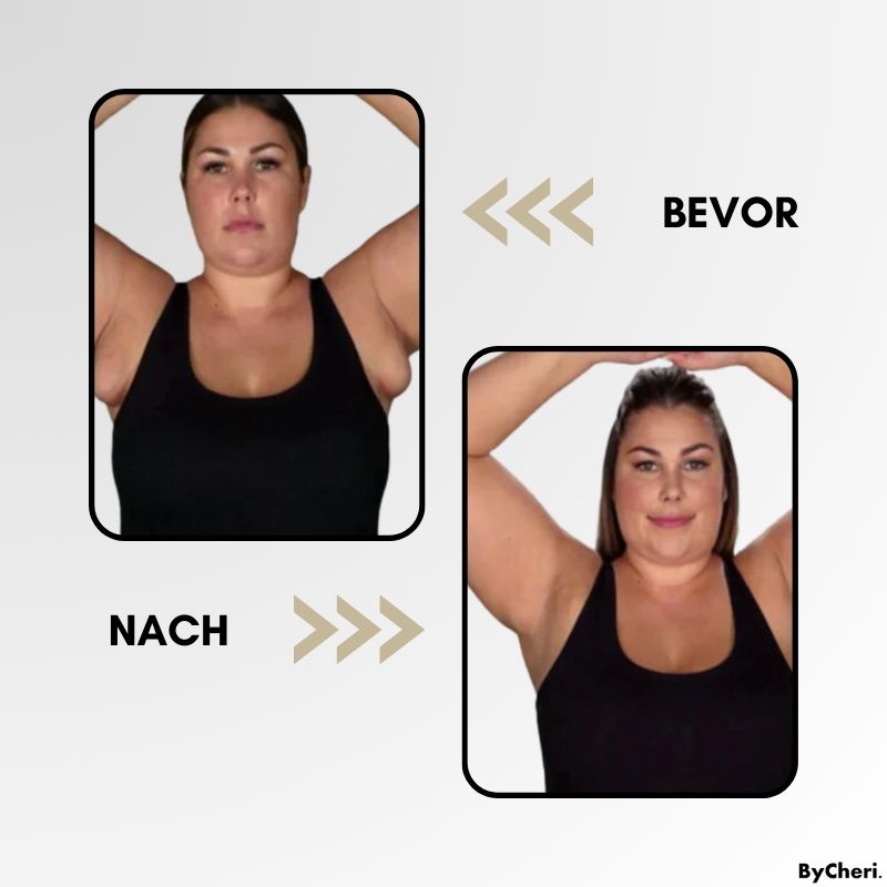LymphWave™ - Bekämpfen Sie hartnäckiges Fett mit lymphatischer Stimulation